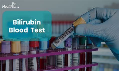 s-ferrit|Ferritin Blood Test: High vs. Low Levels